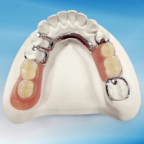 Marco de metal natural Probar en RPD
